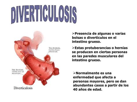 Simple Science: How to Make a Volcano with Kids