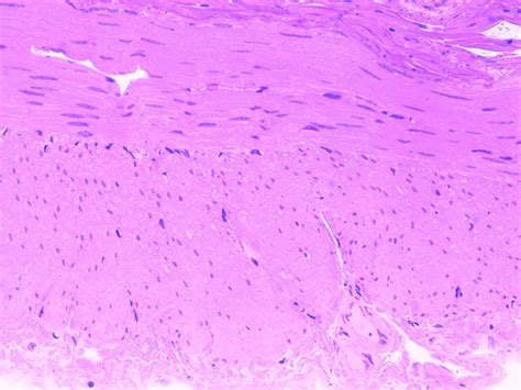 Smooth Muscle Orientations