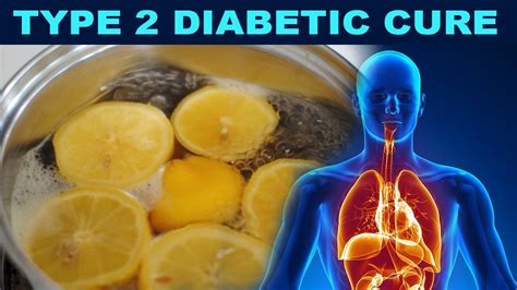 Unbeatable Diabetes Cure Type 2 Diabetic Cure By Naturally At Home