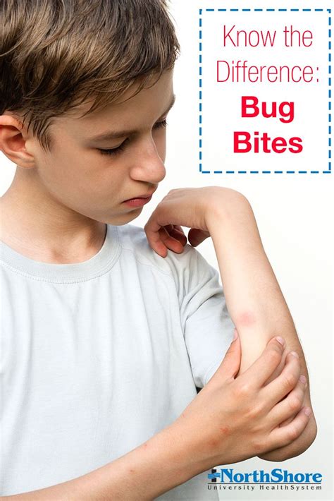 Arm Identifying Bed Bug Bites On Humans