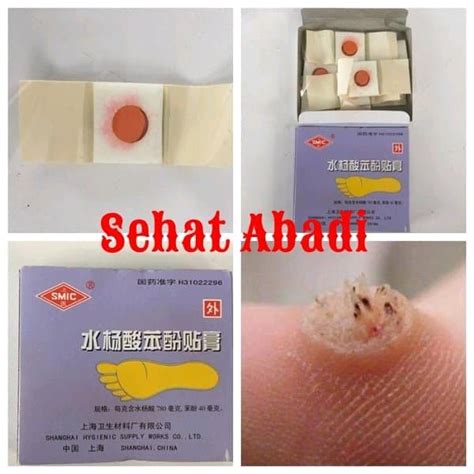 Cara menghilangkan mata ikan di kaki yang pertama anda bisa menggunakan cuka apel untuk melembutkan dan menyingkirkan mata ikan di kaki anda. Jual Obat China Cina Plester Kutil Ji Yan Gao - Obat Kutil ...
