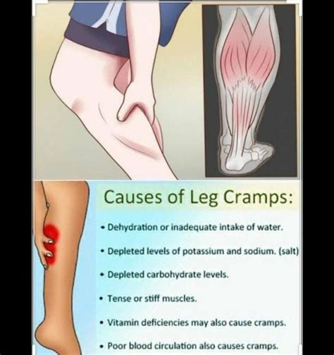 Causes Of Leg Cramps