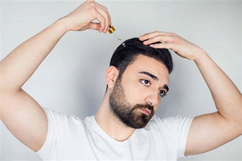 Jenis Dan Manfaat Serum Rambut Untuk Pria Beserta Cara Pakainya