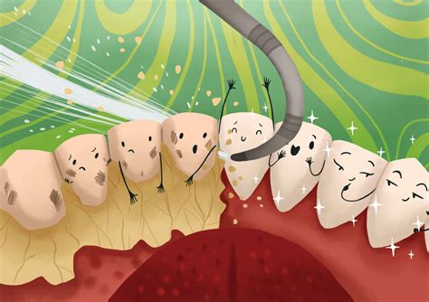 Tartar can make it harder to brush and floss like you should. How To Remove Plaque From Teeth? Home & Professional Remedies