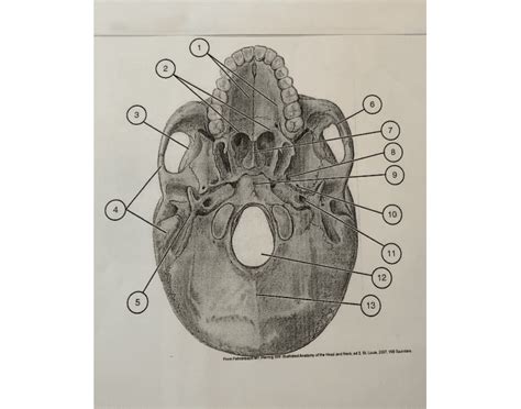 Inferior view of the zygomatic process of the skull. Inferior View of Skull Anatomy