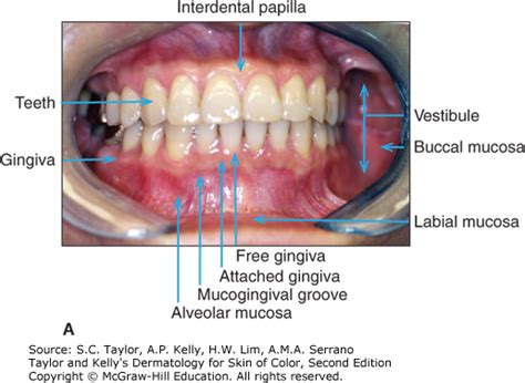 Oral Mucosa Anatomy