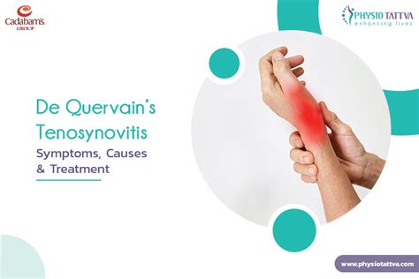 De Quervain Tenosynovitis Symptoms Causes Treatment
