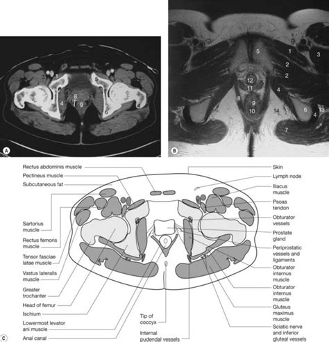 This mri male pelvis axial cross sectional anatomy tool is absolutely free to use. The pelvis | Radiology Key