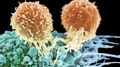 Immunotherapy Using Your Bodys Natural Defenses To Fight Cancer By
