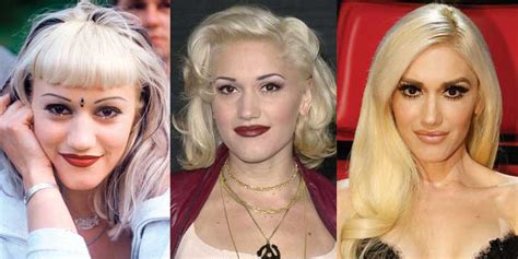 The Truth About Gwen Stefani S Plastic Surgery Plastic Surgery Gwen Vrogue