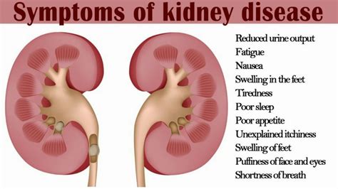 What Is The End Stage Of Kidney Failure Youtube