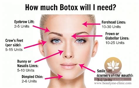 Mengenal Perawatan Kulit Suntik Botox