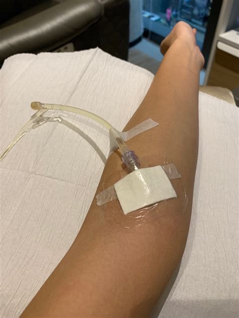 Immunity Boost Iv Drip Review My Experience At Medical Spa Lifehub Hong Kong