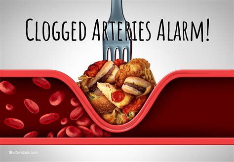 A blockage in one of the carotid arteries can be cleared either by endarterectomy or carotid angioplasty. 7 Signs Of Clogged Arteries To Preclude Imminent Heart ...