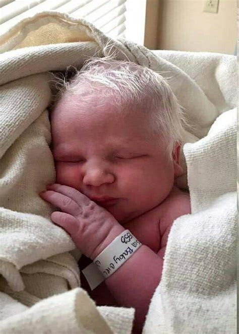 Voici comment ce bébé est né avec les cheveux blancs ! L’infirmière n