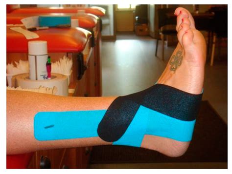 How To Kt Tape An Ankle For Support