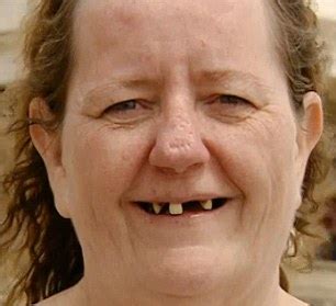 Toothless Grandmother Who Called Herself Fat And Ugly Is Transformed Into Slim Beautiful