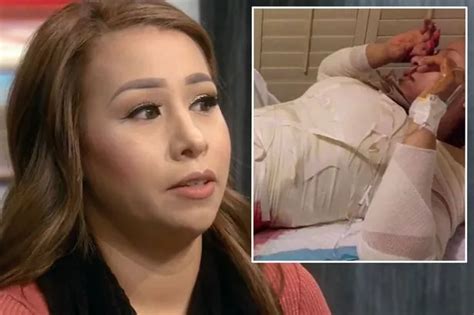 Teen Mum Contracts Gangrene When Deadly Tummy Tuck And Boob Job Goes Dangerously Wrong In Most