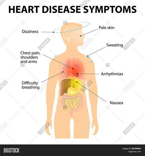 Chest pain can actually happen due to a slew of causes, including quite a after all, your body has a lot going on in that region. Heart Disease Vector & Photo (Free Trial) | Bigstock