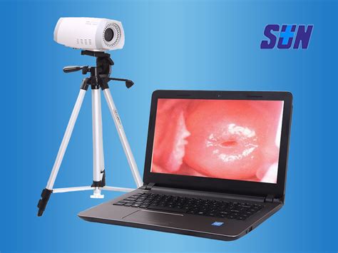 Hospital Colposcope Video Colposcope For Vagina Portable Gynaecology Electronic Digital