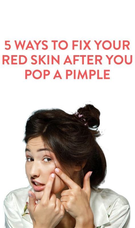 Amazon Extra Off Coupon So Cheap 5 Ways To Fix Your Skin After A Pimple Beauty Skin Skin