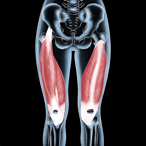 Quadriceps Muscle Injury Recovery Join The Quad Squad