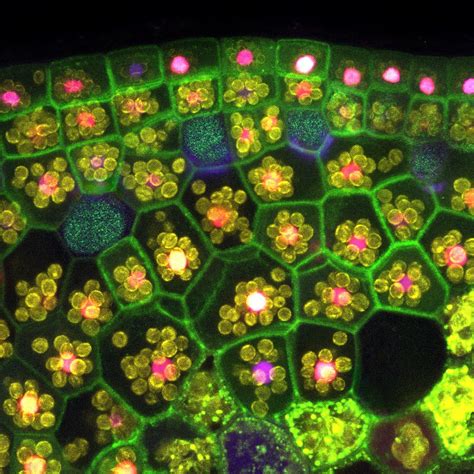 Image Of Stained Plant Tissue That Was Captured Using A Fluorescence