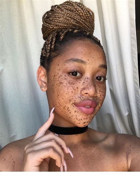 see this instagram photo by blkgirls 14k likes black people with freckles women with