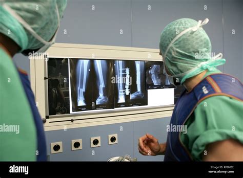 Leg X Ray Hi Res Stock Photography And Images Alamy