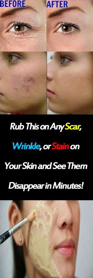 Click The Image — Rub This On Any Scar Wrinkle Or Stain On Your