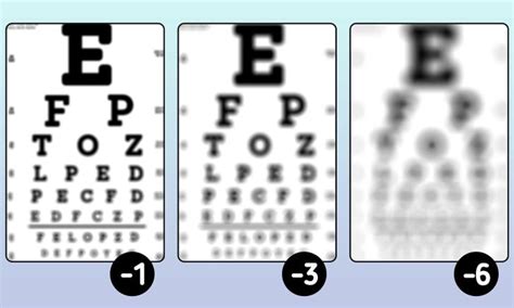 How People With Different Degrees And Causes Of Impaired Vision