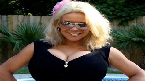 Woman With Worlds Largest Implants Attempts Suicide