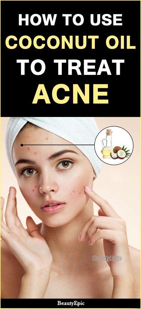 How To Use Coconut Oil To Treat Acne Facecleanserforacnes Coconut