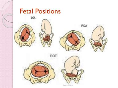 Types Of Fetal Positions