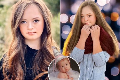 Teen With Downs Syndrome Becomes A Successful Model 15 Years After Mum