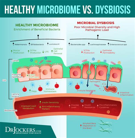 Pin On Gut Health And Microbiome