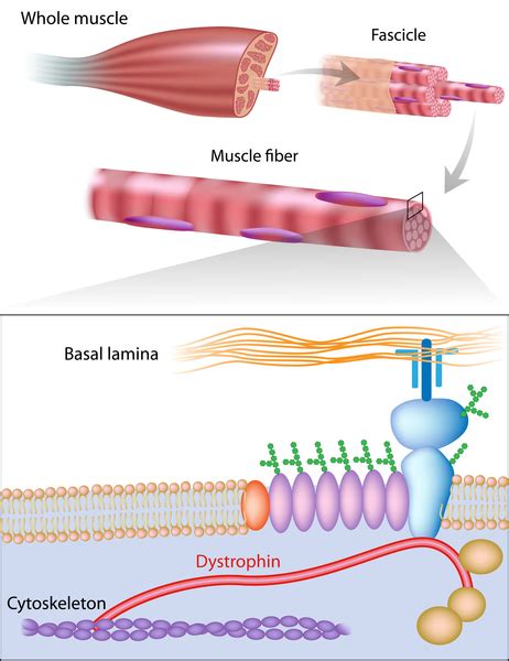 Duchenne Muscular Dystrophy Karyotype