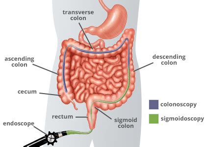 Инструкции по медицинскому применению лекарственных. Colonoscopy - GI Health Centre