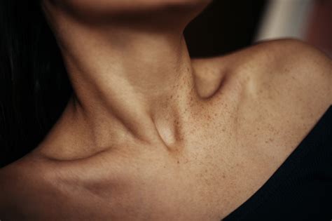 Clavicle Collarbone Pain Causes Home Remedies And Prevention Tips