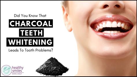 Activated Charcoal Teeth Whitening Does It Cause Any Tooth Problems