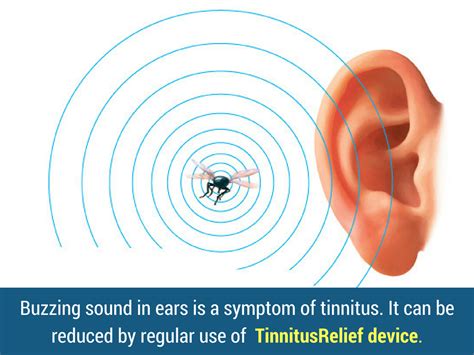 Continuous Buzzing Sound In Ears Is A Symptom Of Tinnitus You Can Get