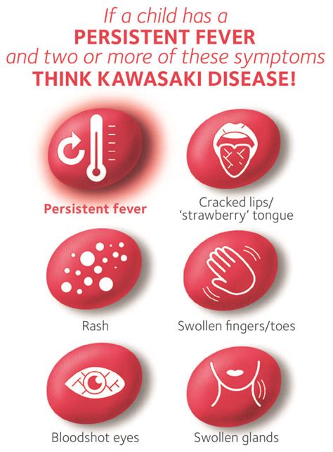 Kawasaki Disease Societi