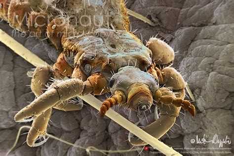The Fine Art Of Microscopy By Science Photographer Martin Oeggerli