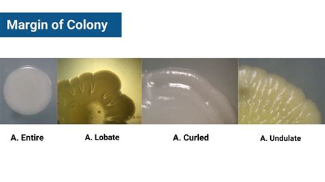 Colony Morphology Examples