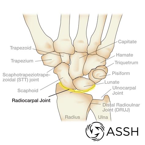 The carpus is slightly concave on the palmar side, forming a canal known as the carpal tunnel through which tendons, ligaments, and nerves extend into the palm. Anatomy 101: Wrist Joints - The Handcare Blog