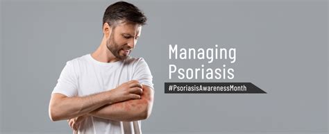 Managing Psoriasis Kdah Blog Health And Fitness Tips For Healthy Life