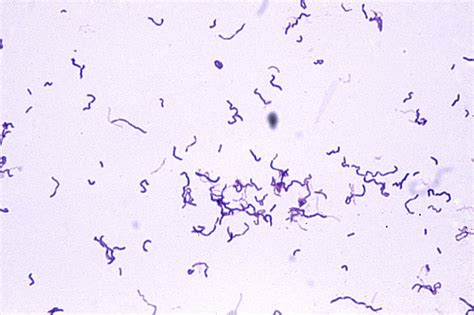 Gram Positive Bacilli Rods Microbiology Learning The Whyology Of