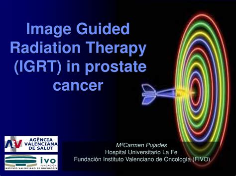 Ppt Image Guided Radiation Therapy Igrt In Prostate Cancer
