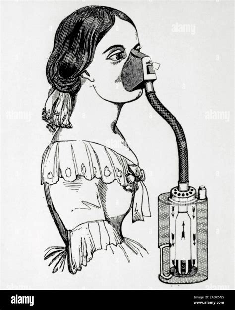 Chloroform Inhaler Illustration Of A Chloroform Inhaler Used In The