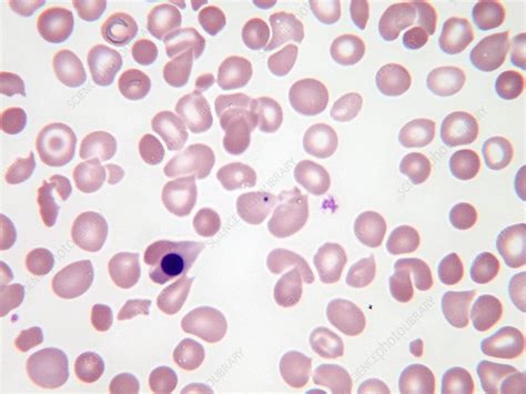 Nucleated Red Blood Cells Lm Stock Image C0435212